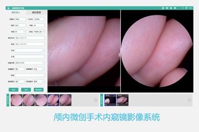 广州维思科技有限公司-内窥镜影像工作站软件外包定制开发