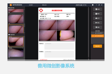 广州维思科技有限公司-内窥镜影像工作站软件外包定制开发